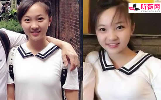 林妙可胸部