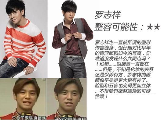 金宇彬整容