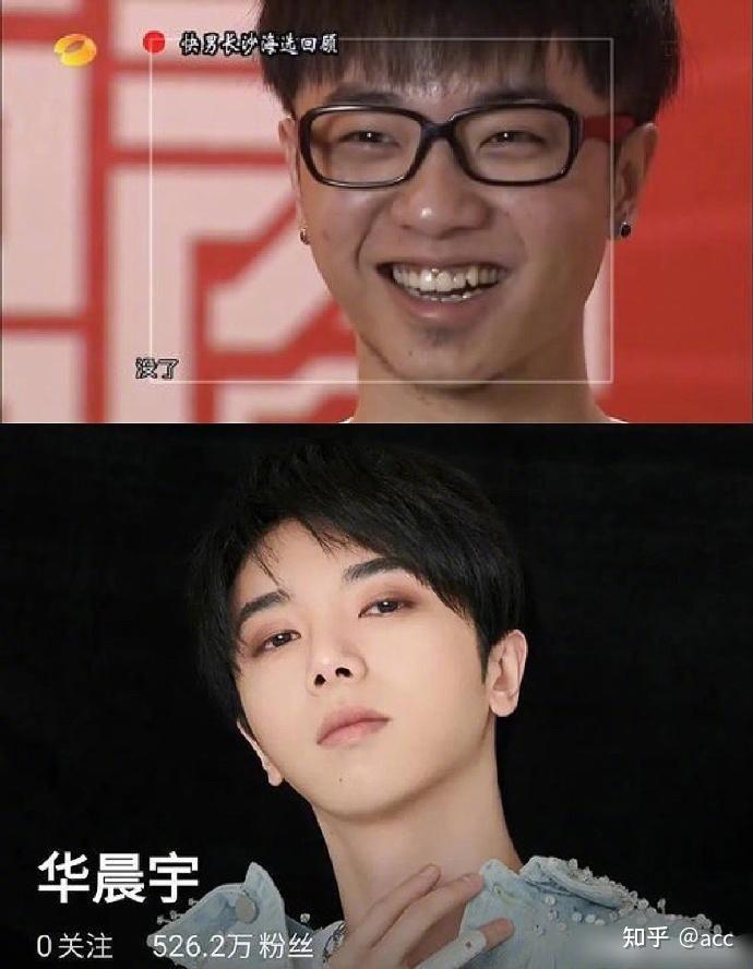 花花整容到什么水平了