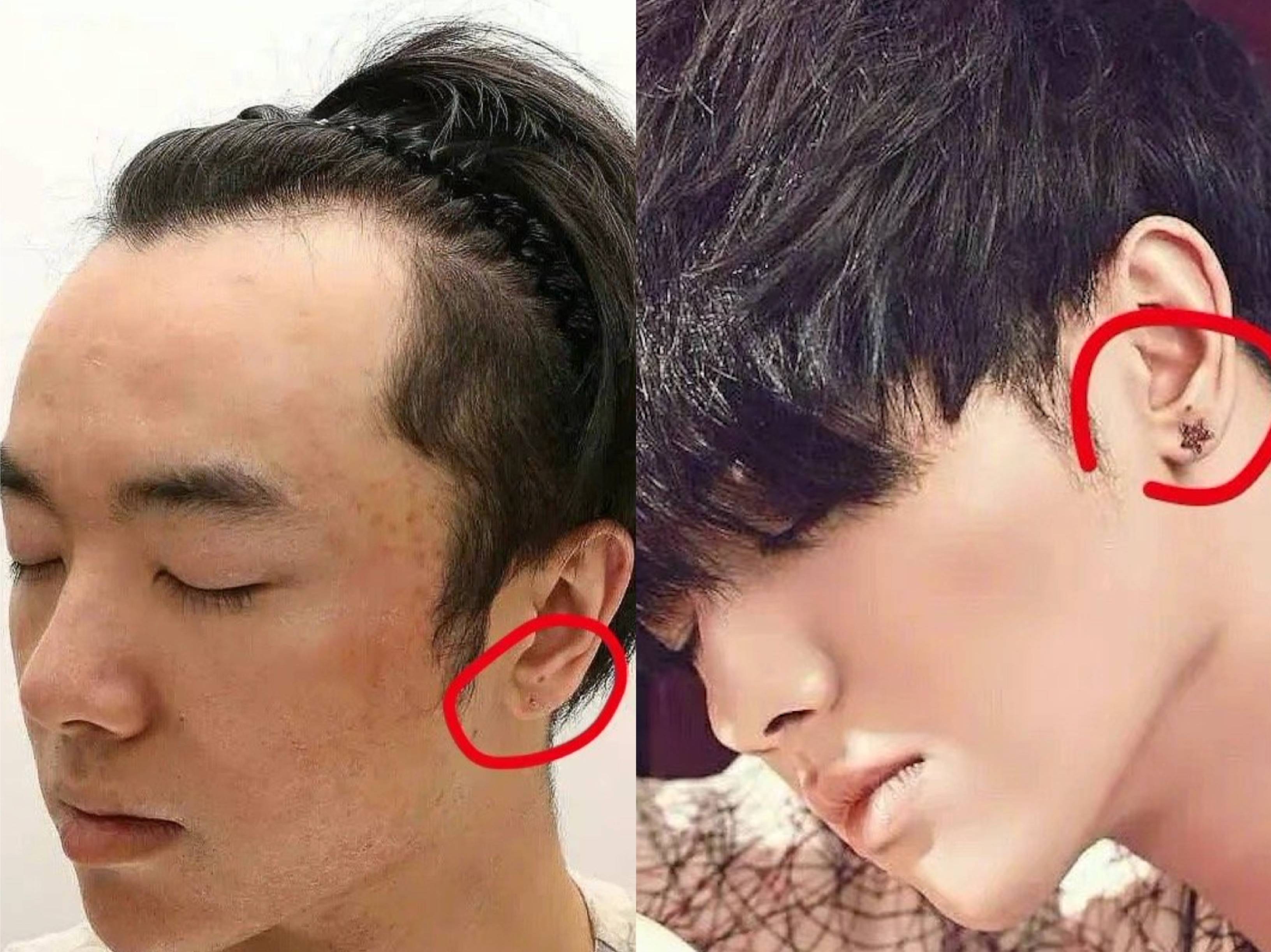 曝华晨宇整容植发的复杂引见