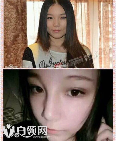 本兮怎么了 本兮怎么了