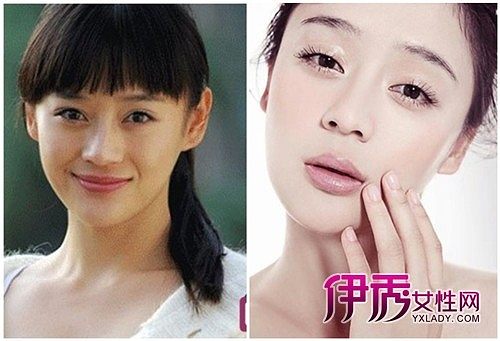 袁珊珊整容