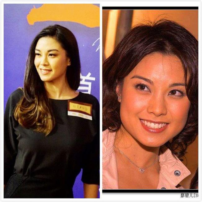廖碧儿整容