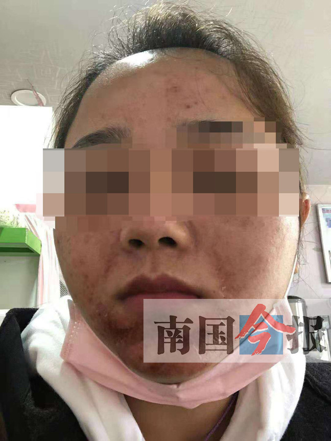毁容门 毁容门