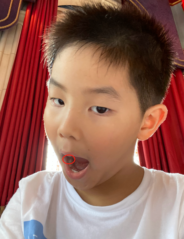 丑小孩