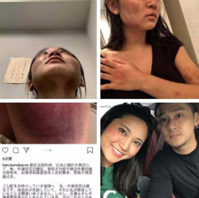 王自健被妻子家暴细节 王自健被妻子家暴细节视频 