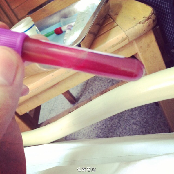 秦思翰 秦思翰治疗没有 
