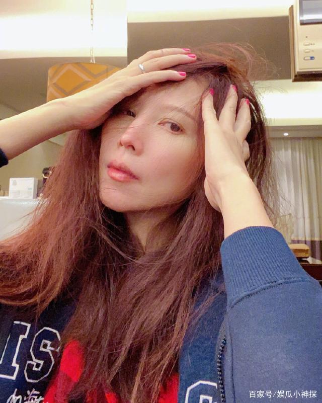 蔡少芬太拼命深夜就诊后立刻返工的简单介绍