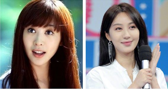 李菲儿整容 李菲儿整容前和整容后的比照图 李菲儿整容 李菲儿整容前和整容后的比照图