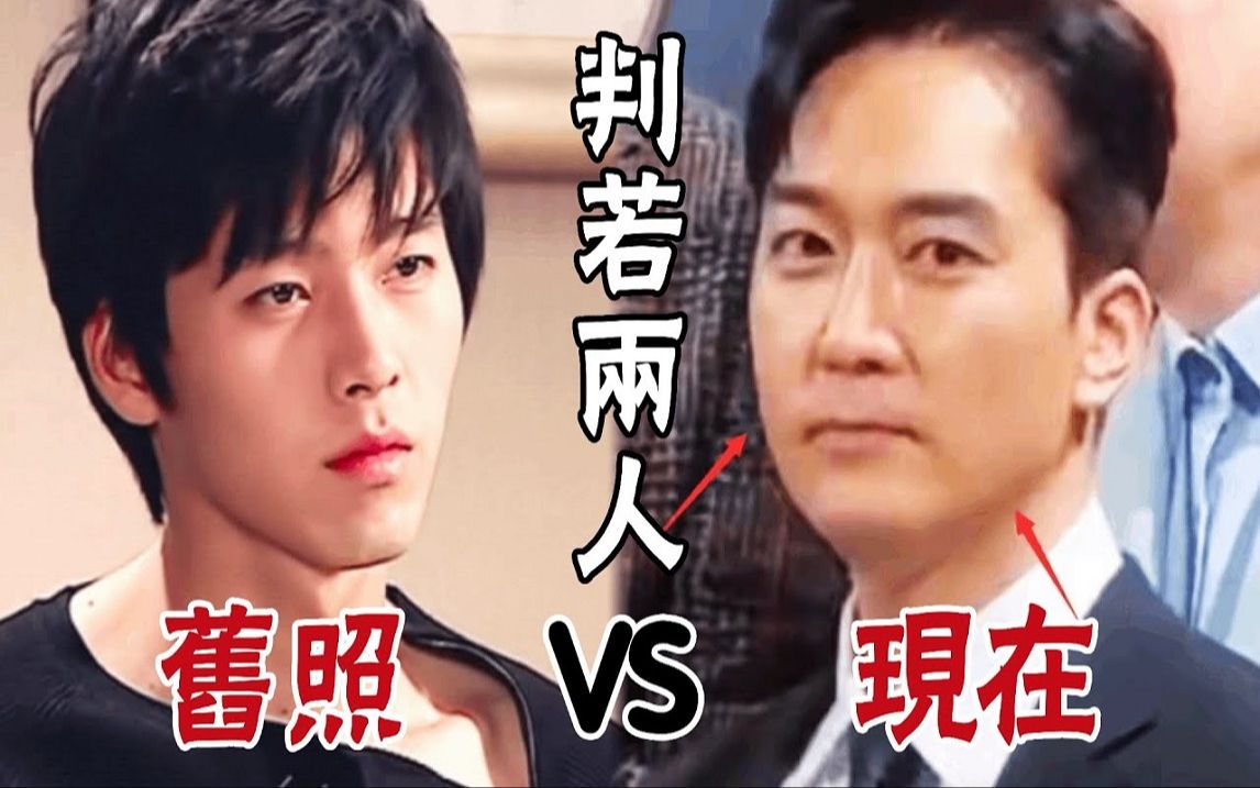 宋承宪整容前照片 宋承宪颜值巅峰 宋承宪整容前照片 宋承宪颜值巅峰