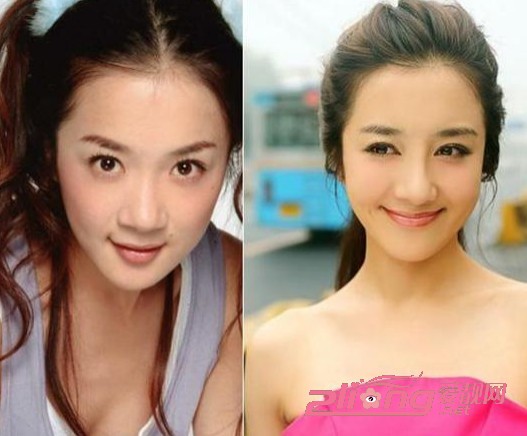 李依晓整容 李依晓整容前古装图片大全