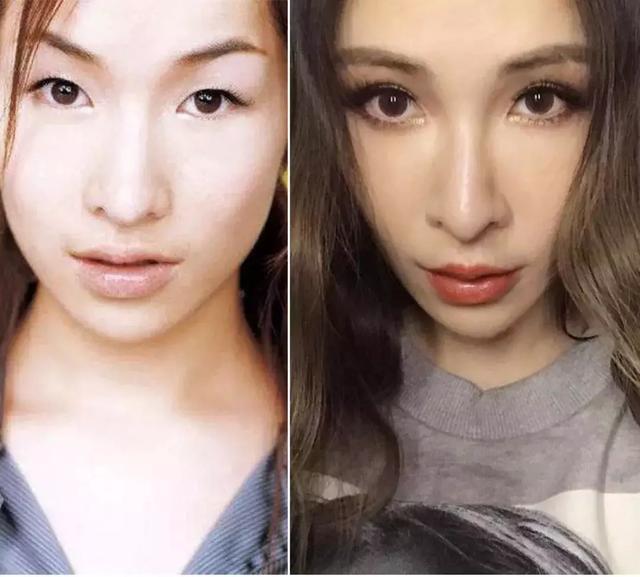 萧亚轩整容前后 萧亚轩整过容没