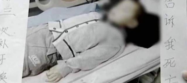 整形护士尸检成效 整形护士尸检成效多久出来 整形护士尸检成效 整形护士尸检成效多久出来