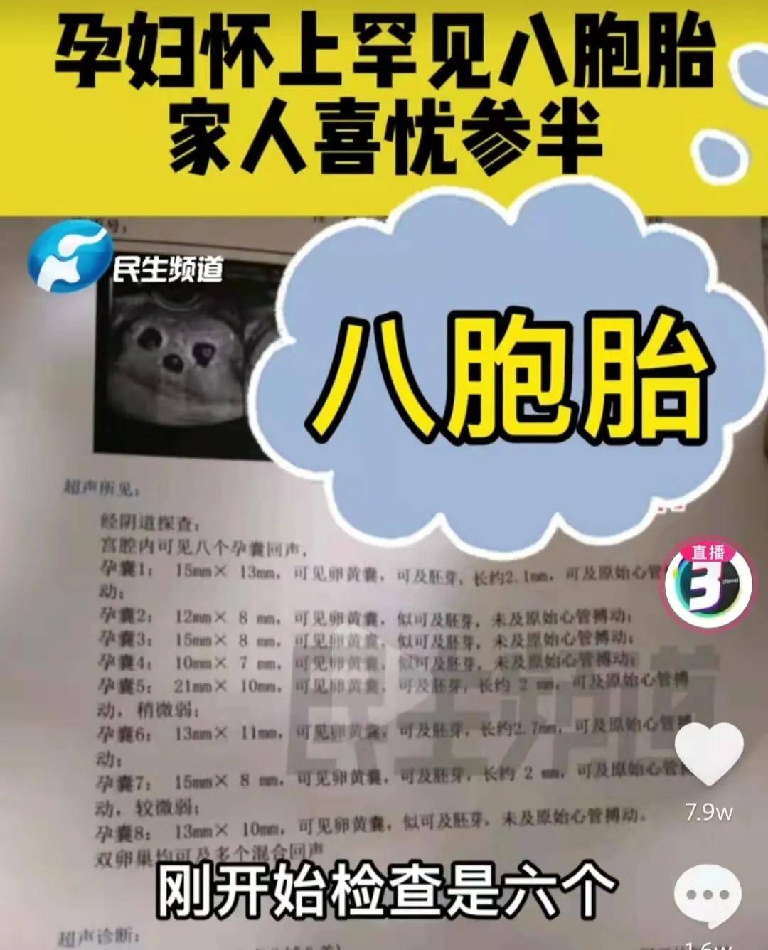 郑州怀八胞胎女子仅18岁 郑州怀八胞胎女子仅18岁以上 郑州怀八胞胎女子仅18岁 郑州怀八胞胎女子仅18岁以上