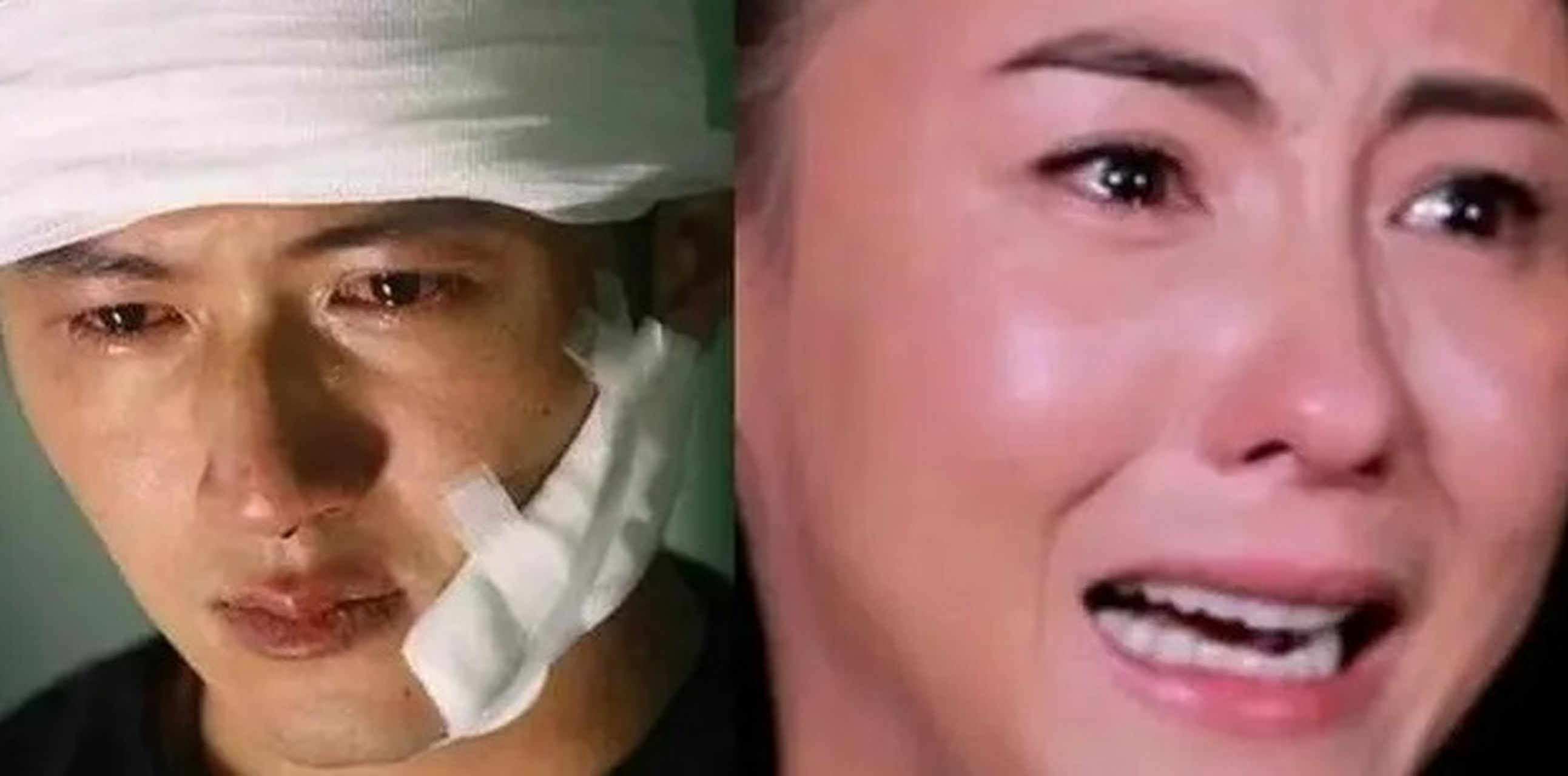 谢霆锋皮肤癌 谢霆锋皮肤癌要扩散吗 谢霆锋皮肤癌 谢霆锋皮肤癌要扩散吗