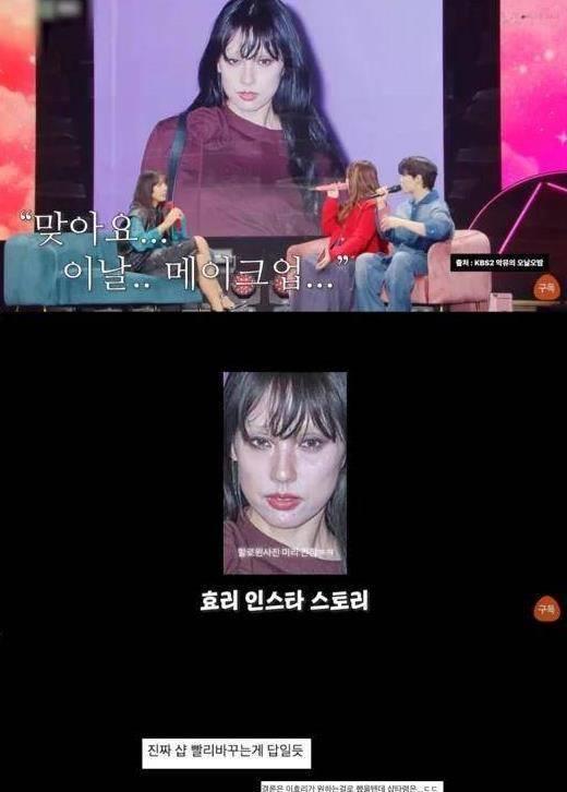李孝利整容 李孝利整容后遗症 