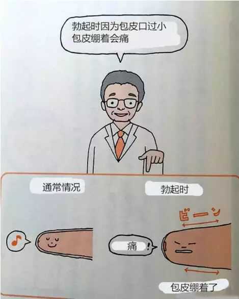 男明星割包皮 男明星割包皮有几团体 