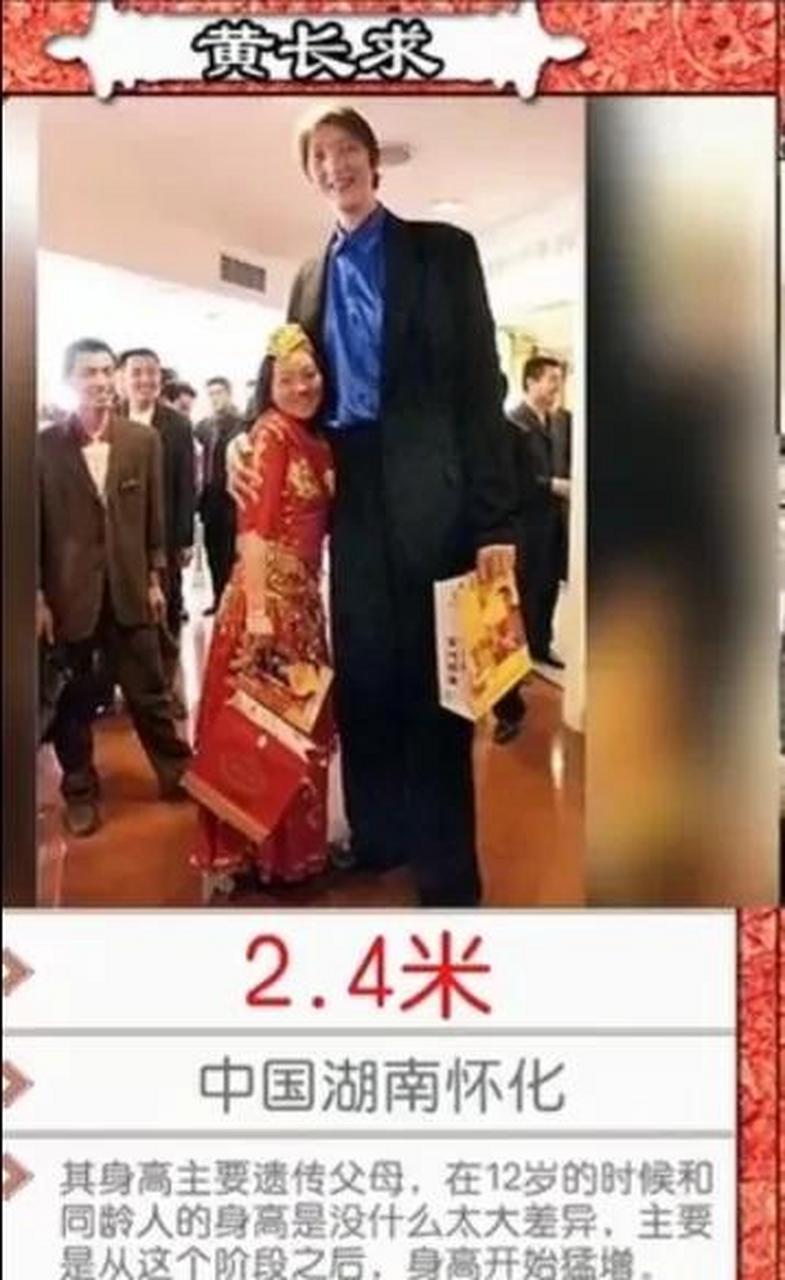 黄长求 黄长求有巨人症吗 黄长求 黄长求有巨人症吗