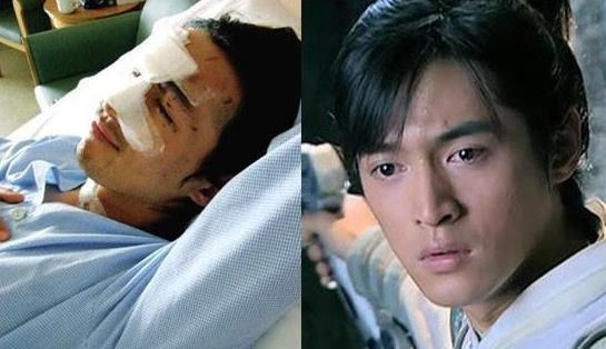 胡歌车祸前后比照图 胡歌车祸前后比照图片 