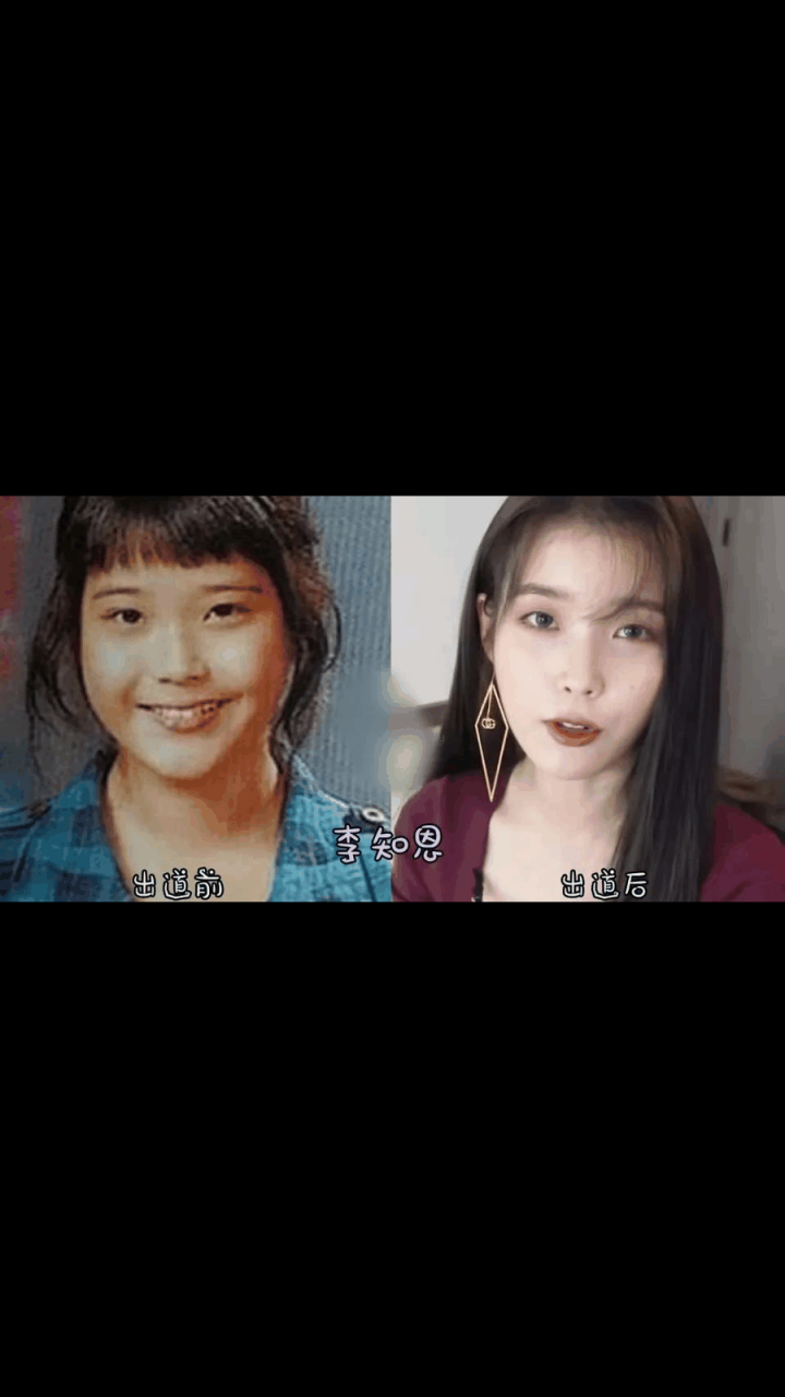 孙艺珍整容 孙艺珍整容前后照片比照 孙艺珍整容 孙艺珍整容前后照片比照