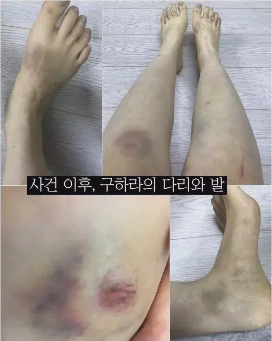 具荷拉事件是什么 具荷拉简介 