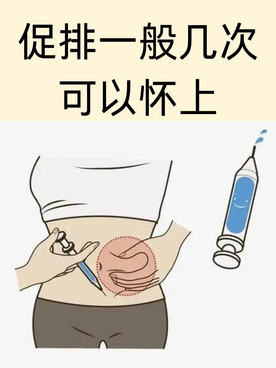 怀八胞胎女子仅18岁曾打促排卵针 八胞胎几率