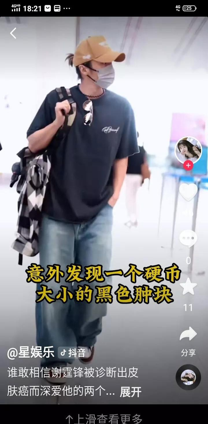 对于谢霆锋患皮肤癌的信息 对于谢霆锋患皮肤癌的信息